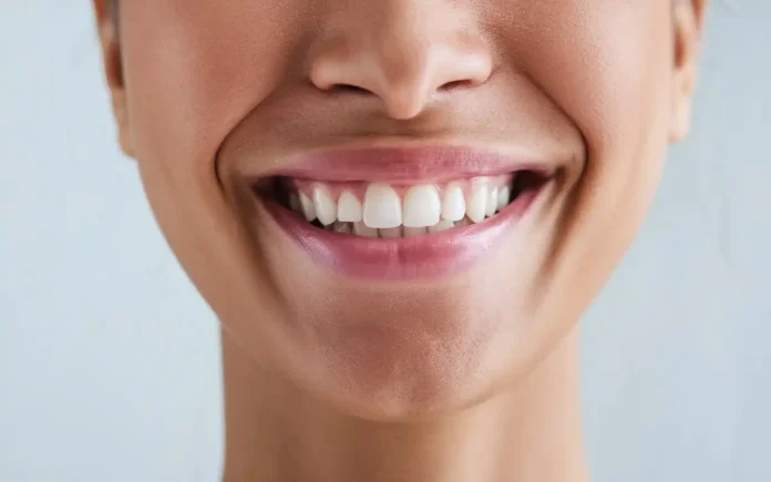 How to tell if your gums are healthy - smiling person showing healthy gums